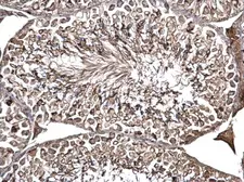 Anti-ODF2 antibody used in IHC (Paraffin sections) (IHC-P). GTX114594