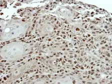 Anti-PSMC5 antibody used in IHC (Paraffin sections) (IHC-P). GTX114676