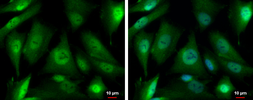 Anti-PSMD4 antibody [N1C2] used in Immunocytochemistry/ Immunofluorescence (ICC/IF). GTX114678