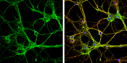 Anti-Munc18-1 antibody used in Immunocytochemistry/ Immunofluorescence (ICC/IF). GTX114809