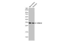 Anti-VDAC2 antibody [N1C2] used in Western Blot (WB). GTX114876