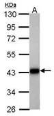 Anti-Aldolase B antibody used in Western Blot (WB). GTX114914