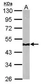 Anti-NDUFS2 antibody used in Western Blot (WB). GTX114924