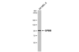 Anti-GPBB antibody [N1N2], N-term used in Western Blot (WB). GTX114952