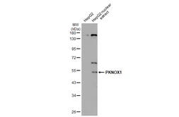 Anti-PKNOX1 antibody used in Western Blot (WB). GTX114991