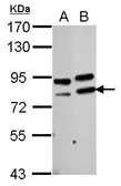 Anti-PARN antibody used in Western Blot (WB). GTX115020