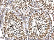 Anti-alpha Tubulin 1A antibody used in IHC (Paraffin sections) (IHC-P). GTX115048