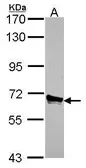 Anti-ACOX3 antibody used in Western Blot (WB). GTX115077