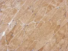 Anti-GPAA1 antibody used in IHC (Paraffin sections) (IHC-P). GTX115131