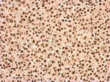 Anti-DDX23 antibody used in IHC (Paraffin sections) (IHC-P). GTX115235