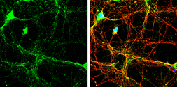 Anti-Homer3 antibody used in Immunocytochemistry/ Immunofluorescence (ICC/IF). GTX115242