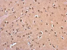 Anti-PSMD6 antibody used in IHC (Paraffin sections) (IHC-P). GTX115303