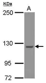 Anti-Strumpellin antibody [C2C3], C-term used in Western Blot (WB). GTX115311