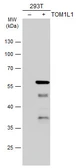 Anti-TOM1L1 antibody [N2C2], Internal used in Western Blot (WB). GTX115333