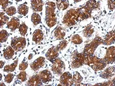 Anti-p16 ARC antibody used in IHC (Paraffin sections) (IHC-P). GTX115342