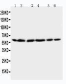 Anti-HSP60 antibody used in Western Blot (WB). GTX11540