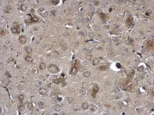 Anti-NTE antibody used in IHC (Paraffin sections) (IHC-P). GTX115501