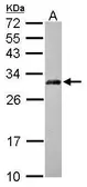 Anti-AP3M2 antibody [N1C1] used in Western Blot (WB). GTX115508