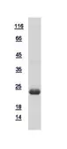 Human DUSP14 protein, His tag. GTX115563-pro