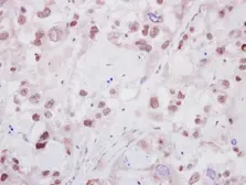 Anti-HELIOS antibody [N3C3] used in IHC (Paraffin sections) (IHC-P). GTX115629
