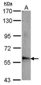 Anti-ABLIM3 antibody [C1C3] used in Western Blot (WB). GTX115642