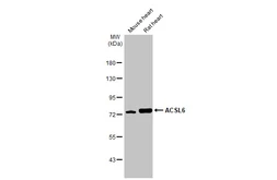 Anti-ACSL6 antibody used in Western Blot (WB). GTX115693