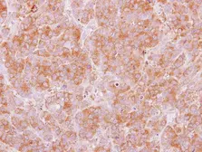 Anti-TRIM29 antibody [C1C3] used in IHC (Paraffin sections) (IHC-P). GTX115749
