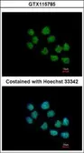 Anti-CREST antibody [N1C2] used in Immunocytochemistry/ Immunofluorescence (ICC/IF). GTX115785