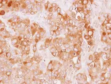 Anti-TRAF3IP1 antibody [N1N2], N-term used in IHC (Paraffin sections) (IHC-P). GTX115798