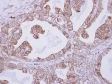 Anti-Cyclin M4 antibody [C2C3], C-term used in IHC (Paraffin sections) (IHC-P). GTX115824