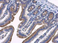 Anti-HOOK2 antibody used in IHC (Paraffin sections) (IHC-P). GTX115898