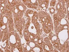 Anti-CEP57 antibody [N1C1] used in IHC (Paraffin sections) (IHC-P). GTX115931