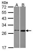 Anti-MTHFS antibody [N1C3] used in Western Blot (WB). GTX115971