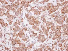 Anti-MAGEA4 antibody used in IHC (Paraffin sections) (IHC-P). GTX116357