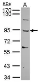 Anti-TMTSP antibody [N3C2], Internal used in Western Blot (WB). GTX116397