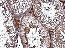 Anti-PPP2R2D antibody [N2C3] used in IHC (Paraffin sections) (IHC-P). GTX116609