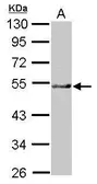 Anti-NARFL antibody used in Western Blot (WB). GTX116764