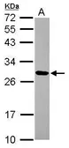 Anti-MRPL9 antibody [N2C3] used in Western Blot (WB). GTX116779