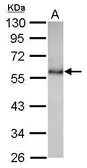 Anti-CHST9 antibody [N3C3] used in Western Blot (WB). GTX116917