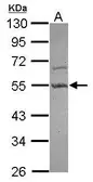 Anti-PARD6B antibody [N1N3] used in Western Blot (WB). GTX116985