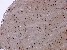 Anti-NAV2 antibody used in IHC (Paraffin sections) (IHC-P). GTX117023