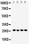Anti-Surfactant Protein A antibody used in Western Blot (WB). GTX11706