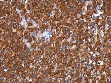 Anti-RGS6 antibody used in IHC (Paraffin sections) (IHC-P). GTX117121