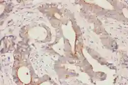 Anti-FABP5 antibody used in IHC (Paraffin sections) (IHC-P). GTX11725