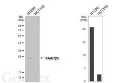 Anti-FAAP24 antibody [N1C3] used in Western Blot (WB). GTX117277