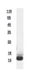 Human RBP1 protein, His tag. GTX117328-pro
