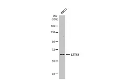 Anti-LZTS1 antibody [C1C3] used in Western Blot (WB). GTX117376
