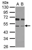 Anti-TAPBPL antibody [N2C3] used in Western Blot (WB). GTX117602