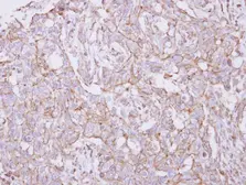 Anti-TXNDC9 antibody [N1C3-2] used in IHC (Paraffin sections) (IHC-P). GTX117713