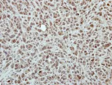Anti-RPP30 antibody [N1C3] used in IHC (Paraffin sections) (IHC-P). GTX117754